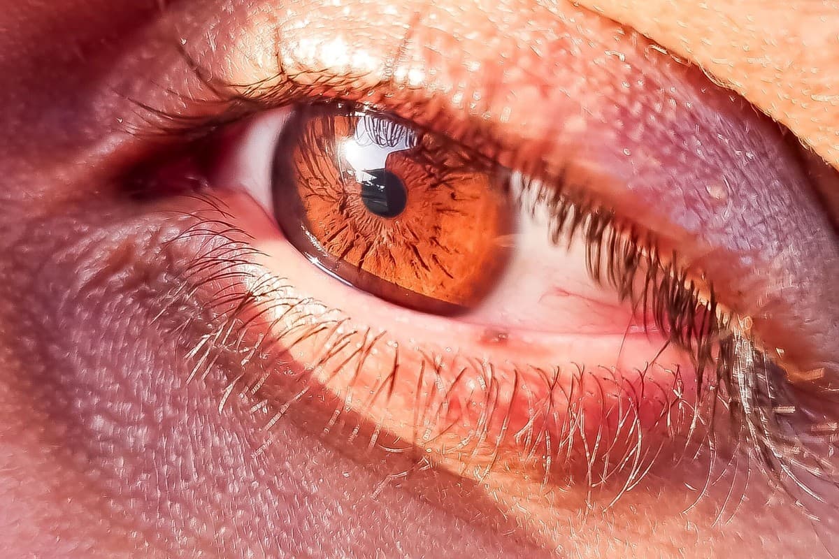 Close-up view of the eye