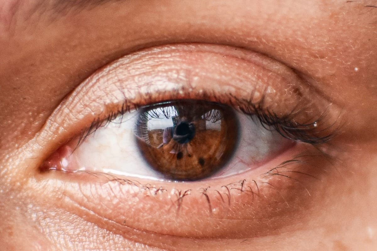 Close-up view of the ocular surface