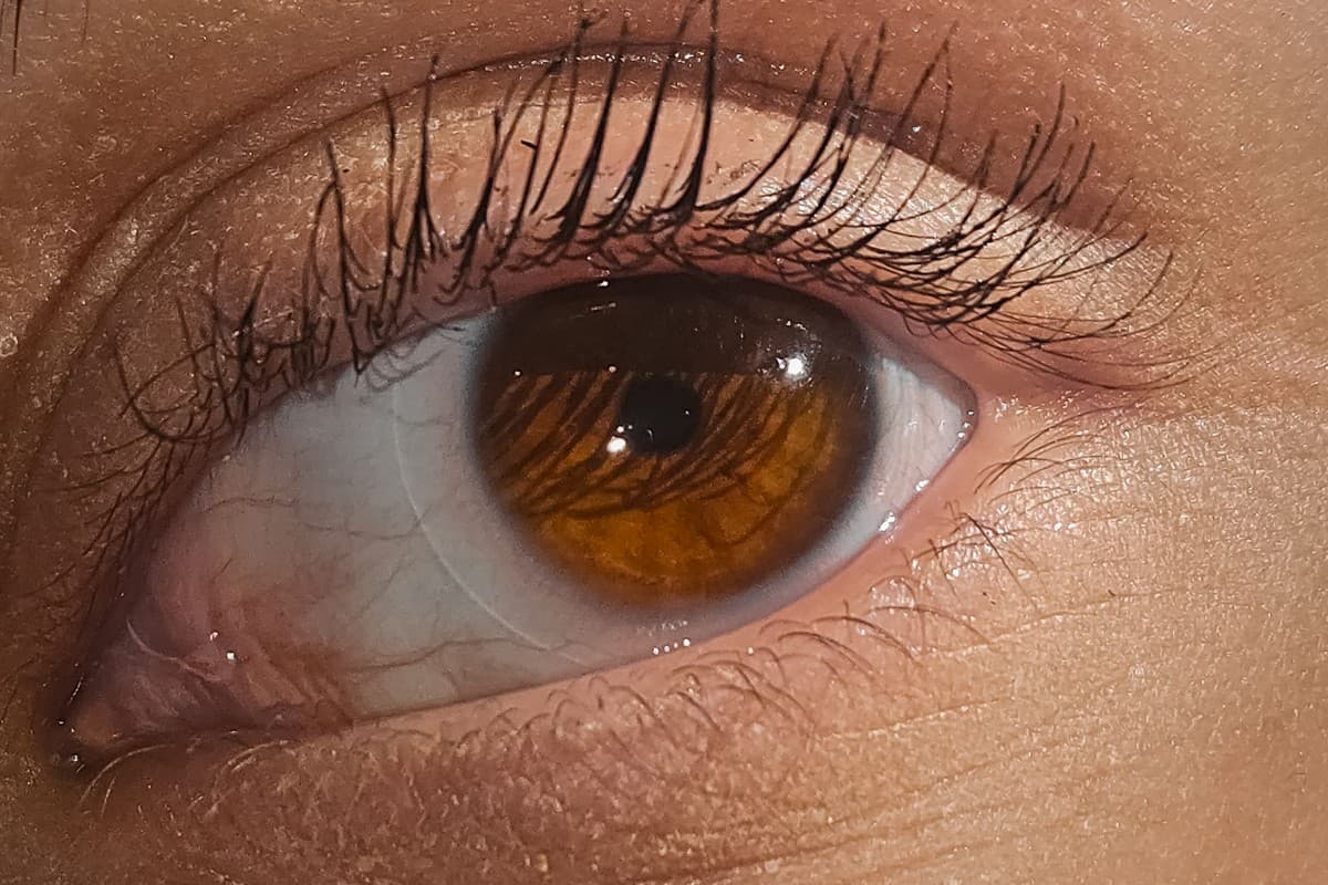 Close-up view of the cornea and front of the eye